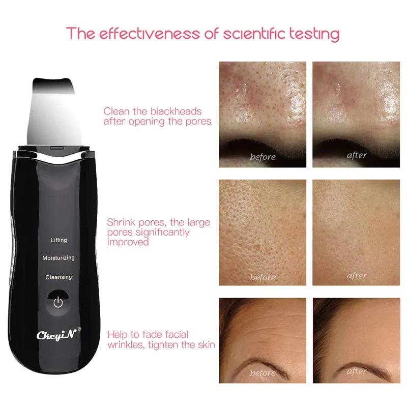 Ultrasonic Skin Scrubber  + Skin Rejuvenation Nano Face Mist Steamer